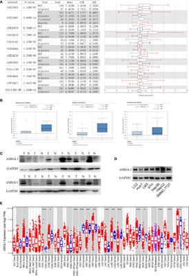 ASRGL1 Correlates With Immune Cell Infiltration in Hepatocellular Carcinoma and Can Serve as a Prognostic Biomarker